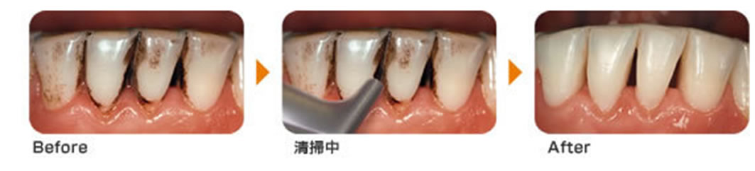 ���̃N���[�j���O