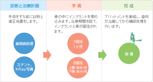 �C���v�����g�@���Â̐i�ߕ�