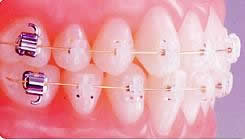 ���̋���