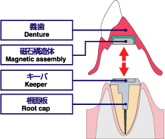 �}�O�l�b�g�`��