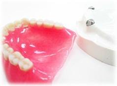 �}�O�l�b�g�`��