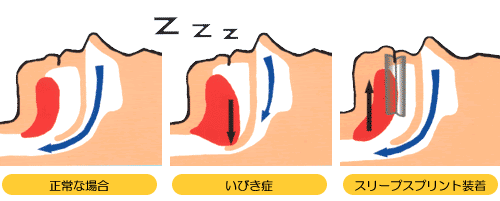 ���ċz���ÃC���[�W