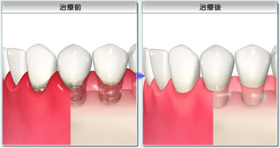 ���ÑO�E���Ì�