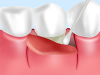 �����O��