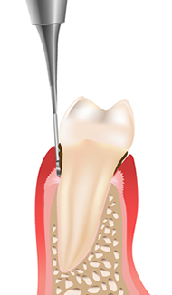 ��p�X�P�[���[